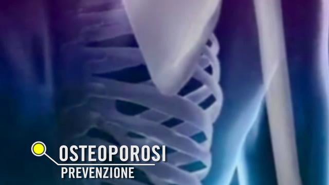 Osteoporosi. E' vero che bisogna bere più latte? - Cucina Consapevole ®